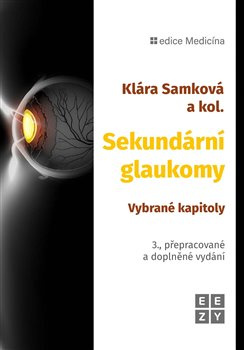 Sekundární glaukomy 3. přepracované a doplněné vydání