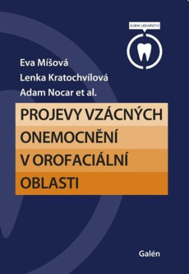 Projevy vzácných onemocnění v orofaciální oblasti 